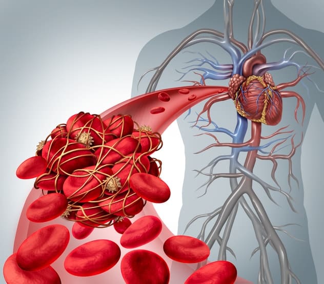 5 Natural Blood Thinners Reduce Risk of Blood Clots