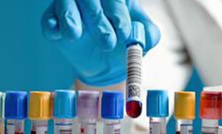 Blood Test Can Help Personalize Depression Treatments
