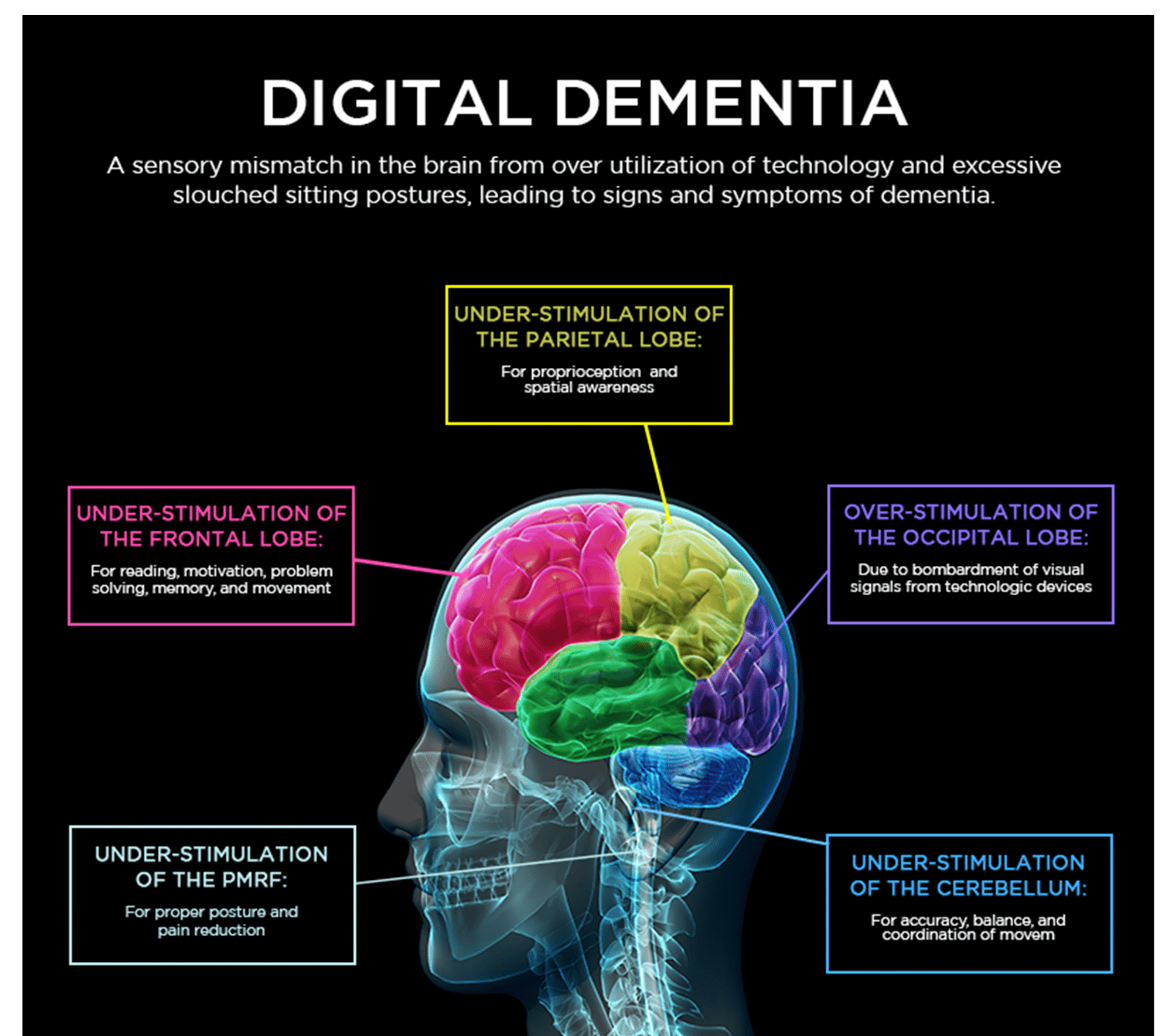 From Tech Neck To Digital Dementia