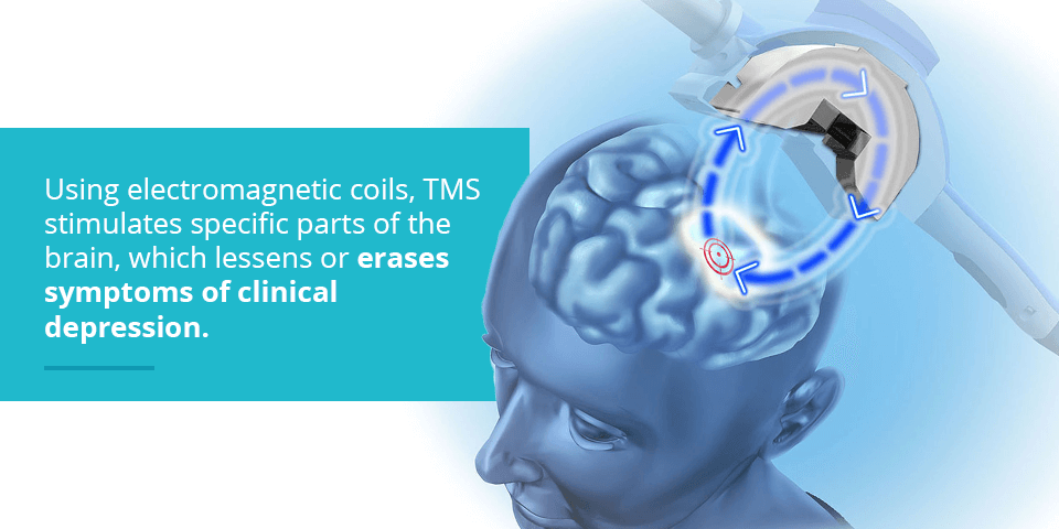 How Long Does a TMS Treatment Last?