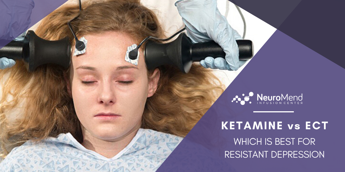 Ketamine vs ECT: Which Is Best For Resistant Depression