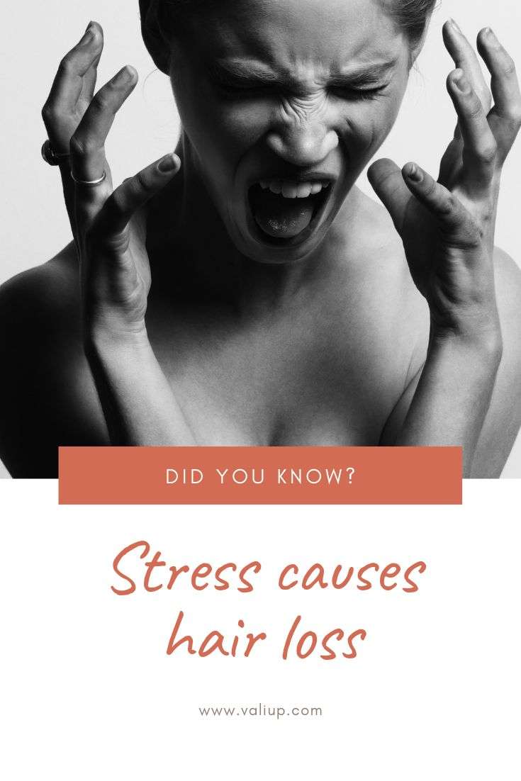 Stress causes hair loss