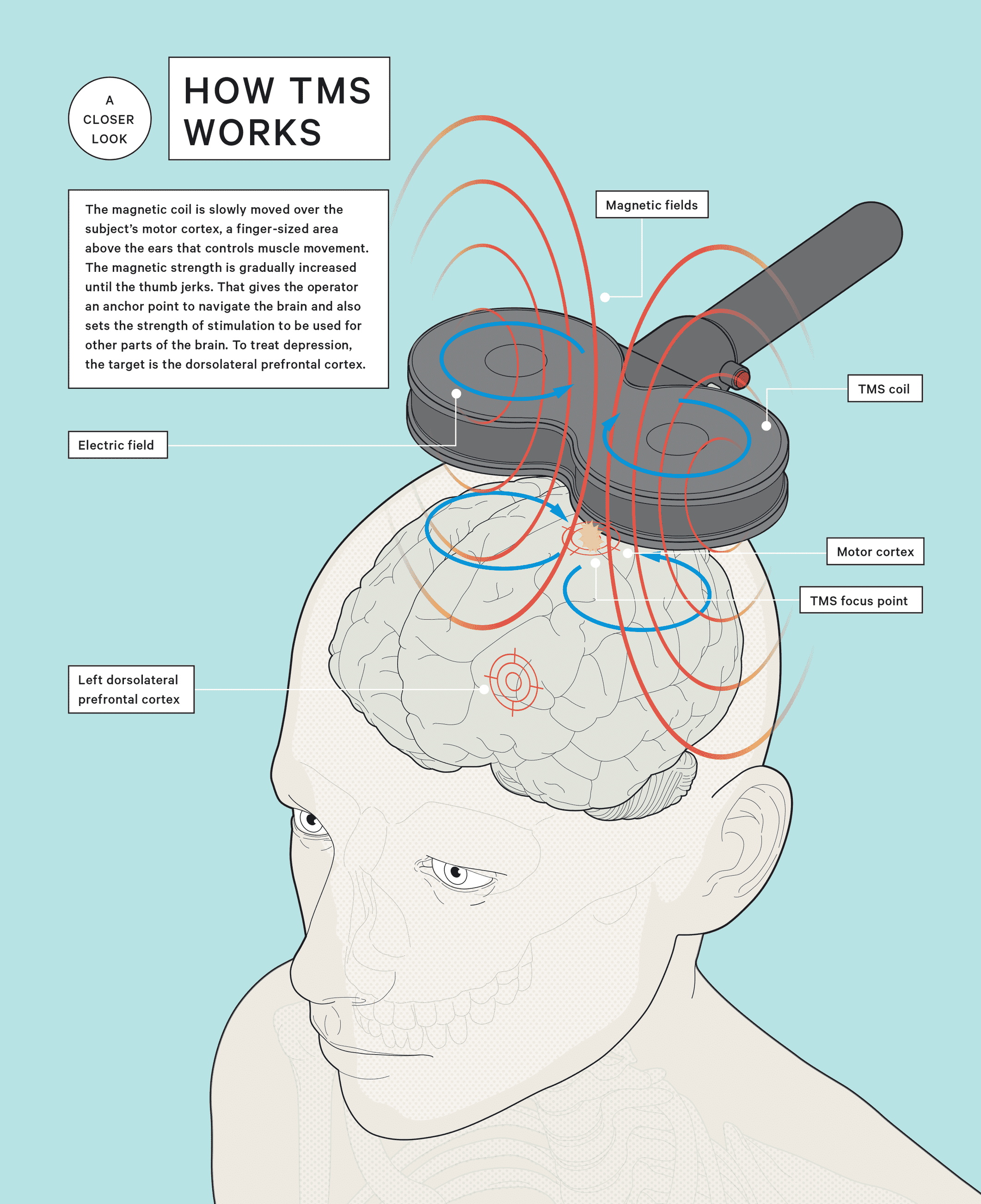 The buzz around brain stimulation