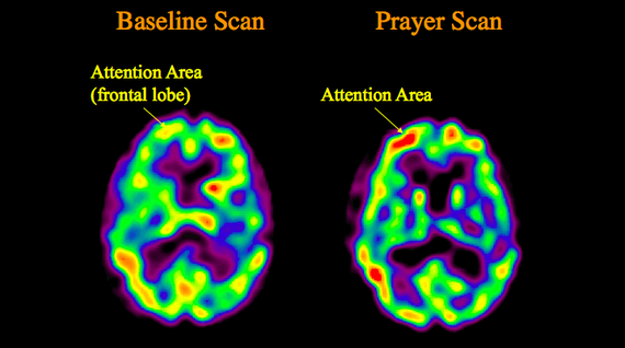 What Happens to the Brain During Spiritual Experiences?