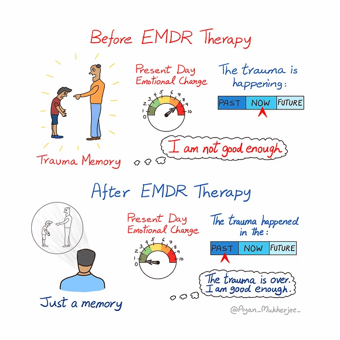 What is EMDR Therapy?